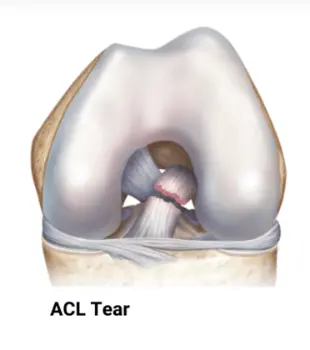 Prevention Anatomy