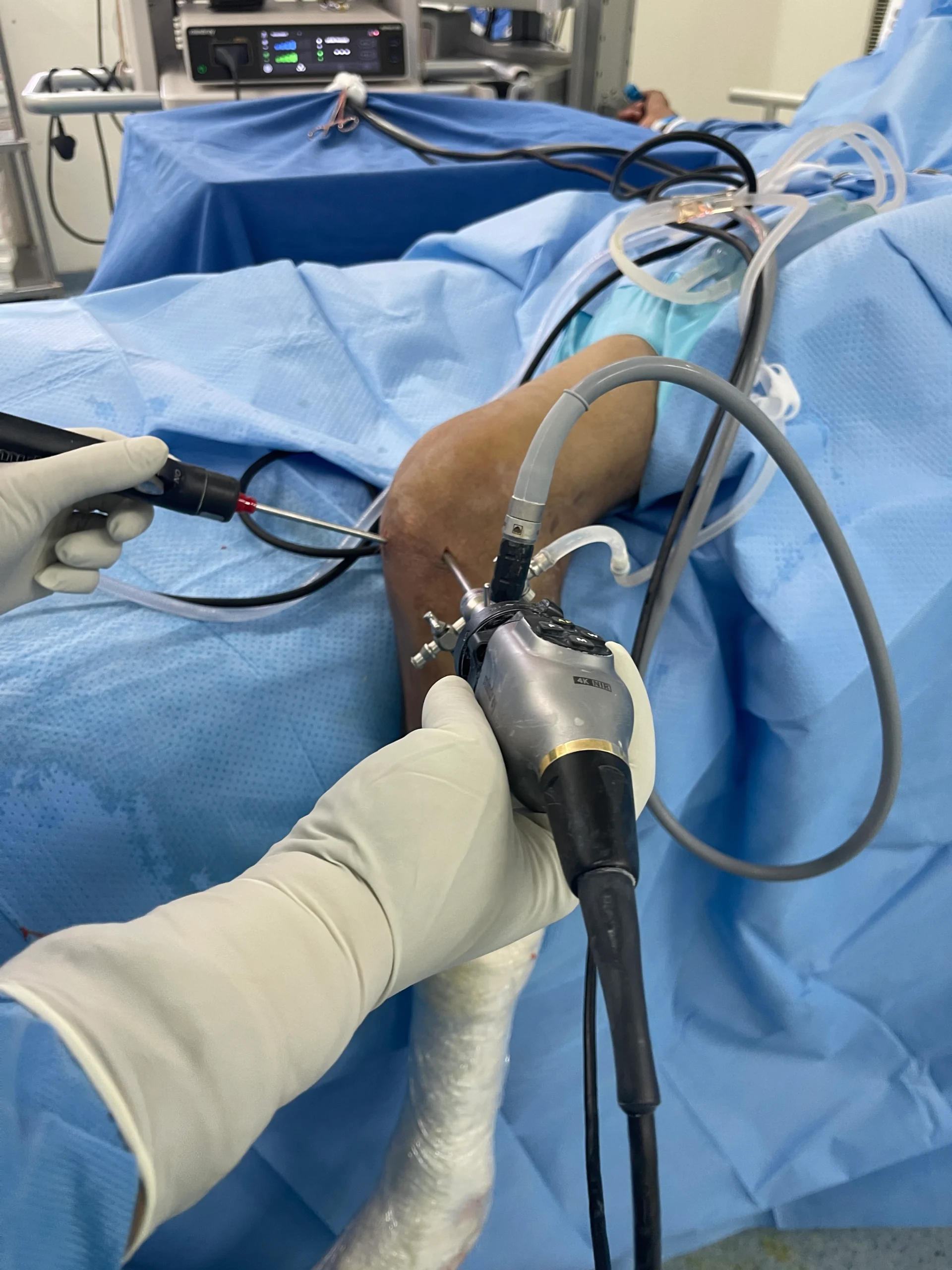 Surgical Procedure