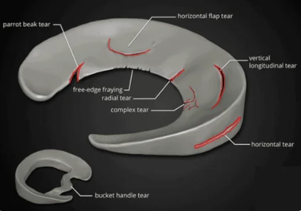 Tears Diagram Overview