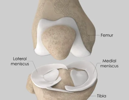 Femur and Tibia Joint Bone Alignment Diagram