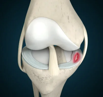 Knee Joint Anatomy