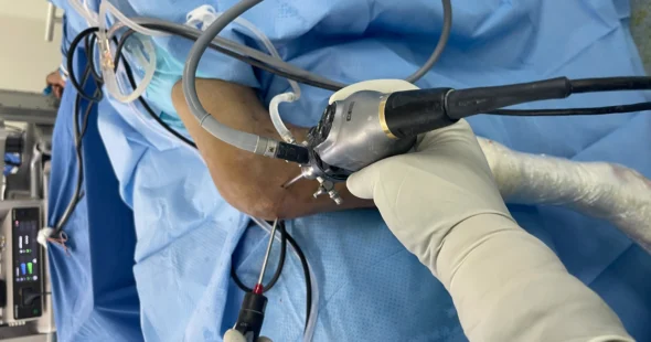 Arthroscopic Surgery Procedure