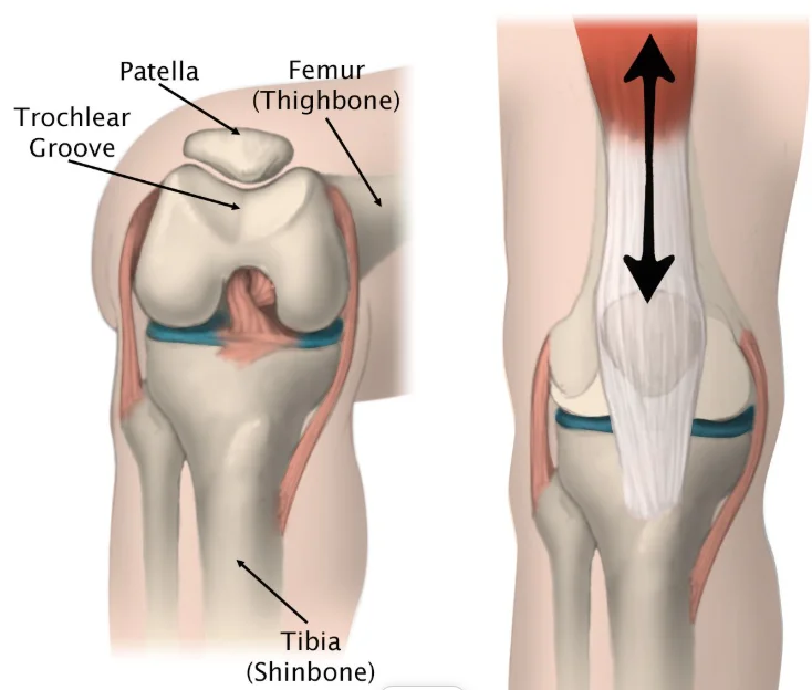 Normal Patella vs Patella Alta Layout