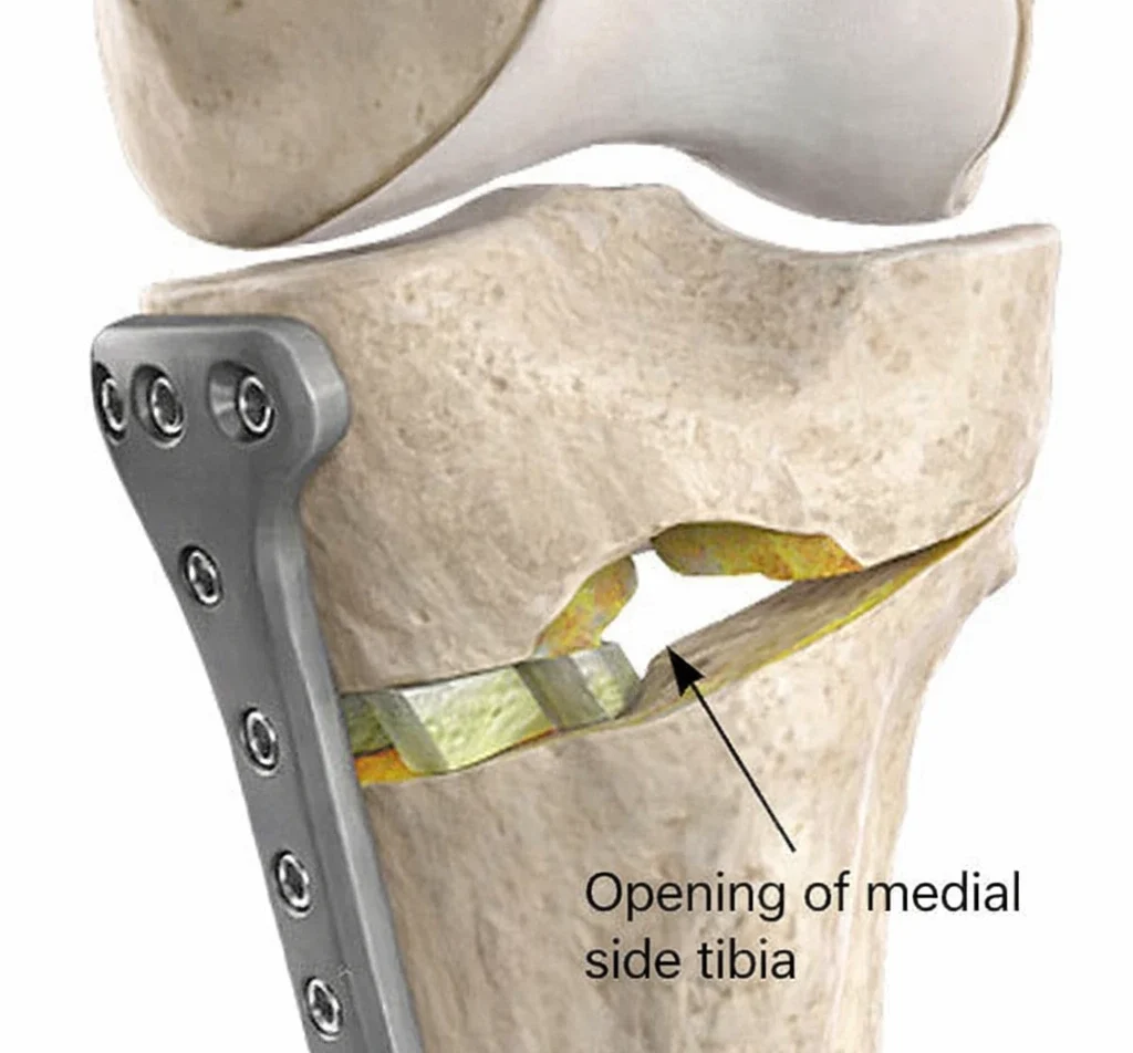 Recovery Process Visual