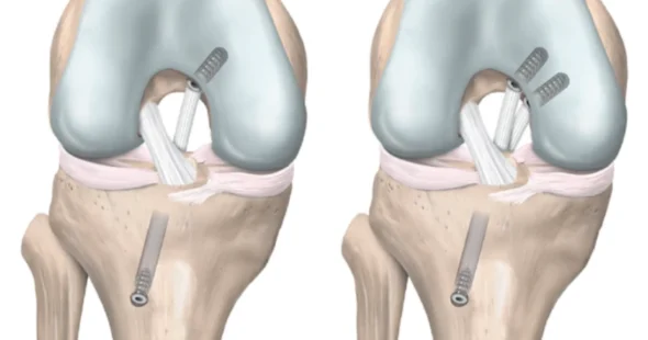 Surgery Map