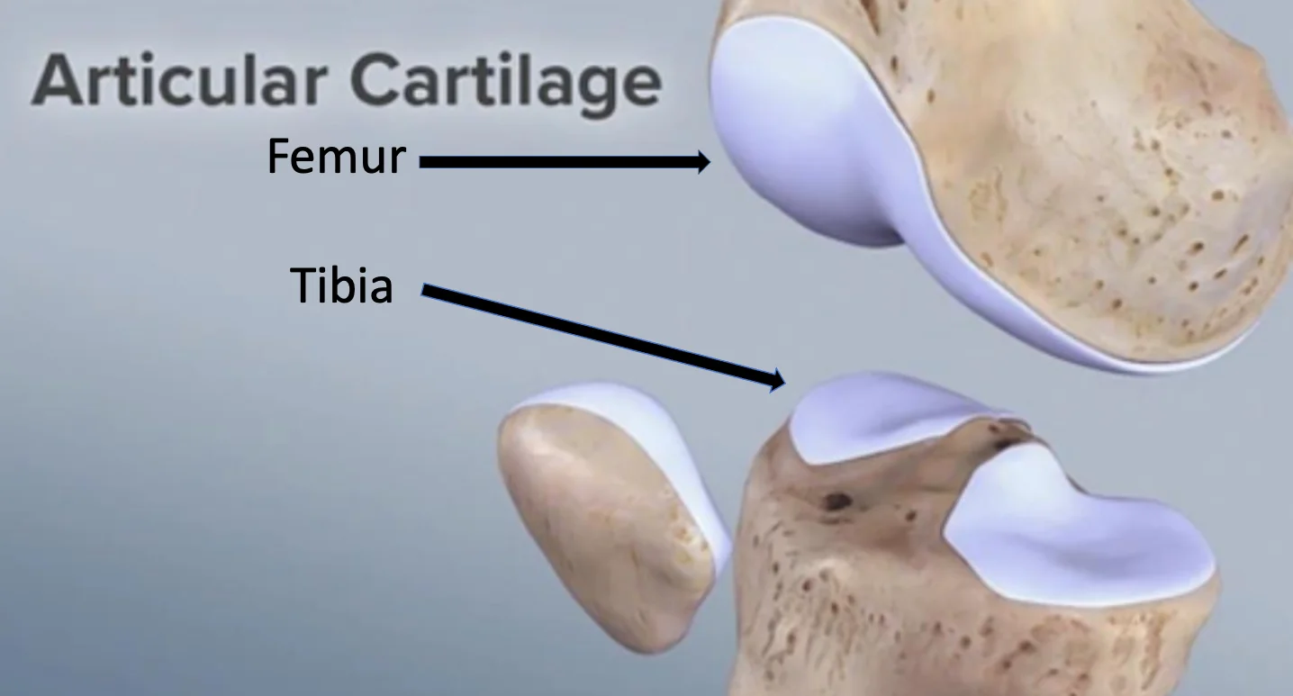 Knee Joint Cartilag Defects Dr Manish Aroraa