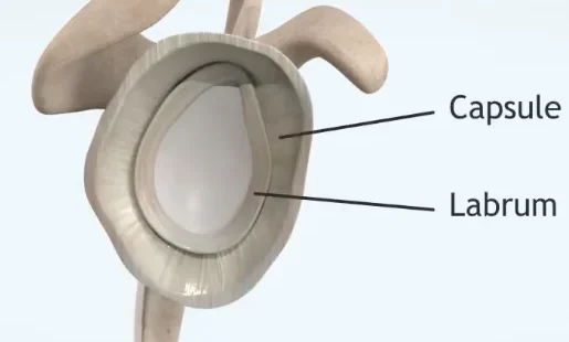 Shoulder Dislocation Dr Manish Aroraa